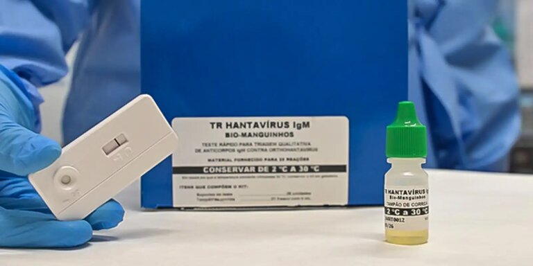 brasil-nao-tem-circulacao-do-hantavirus-que-causou-surto-em-navio