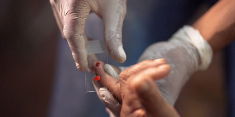 pesquisa-da-fiocruz-abre-caminho-para-vacina-universal-contra-malaria