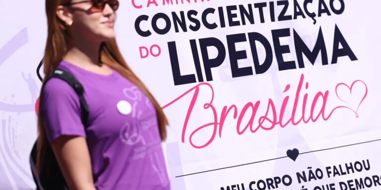 lipedema:-doenca-cronica-vai-alem-da-questao-estetica
