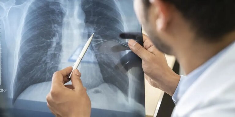 cancer-de-pulmao:-pesquisa-aponta-frequencia-de-mutacao-do-gene-egfr